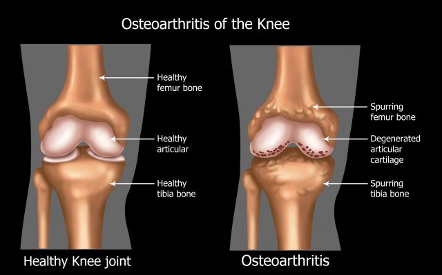 Illustration of the knee